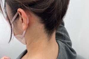 名古屋で最近うなじ脱毛がブームになっている理由！