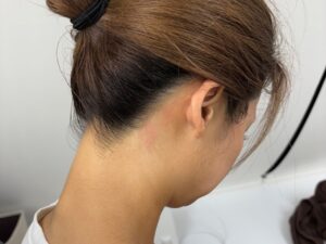 脱毛サロンの中でもうなじ脱毛サロン今流行ってる！？名古屋の脱毛サロンの状況を調査！