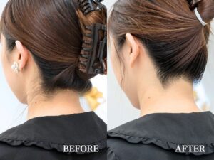 うなじ脱毛は夏にピッタリの美容！うなじは多くの周りの人に見られています！