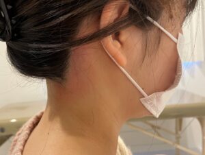 うなじは男子から見られている！うなじ脱毛で解決！『ミース名古屋駅前店』に来てください！